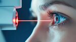 LASIK, Femto-LASIK или ФРК: какую лазерную коррекцию выбрать?